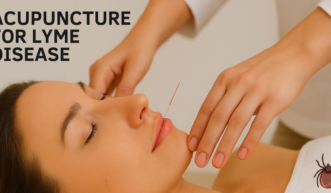 Struggling with Lyme Disease in Sarasota? Acupuncture and Chinese Medicine May Be the Relief You Need
